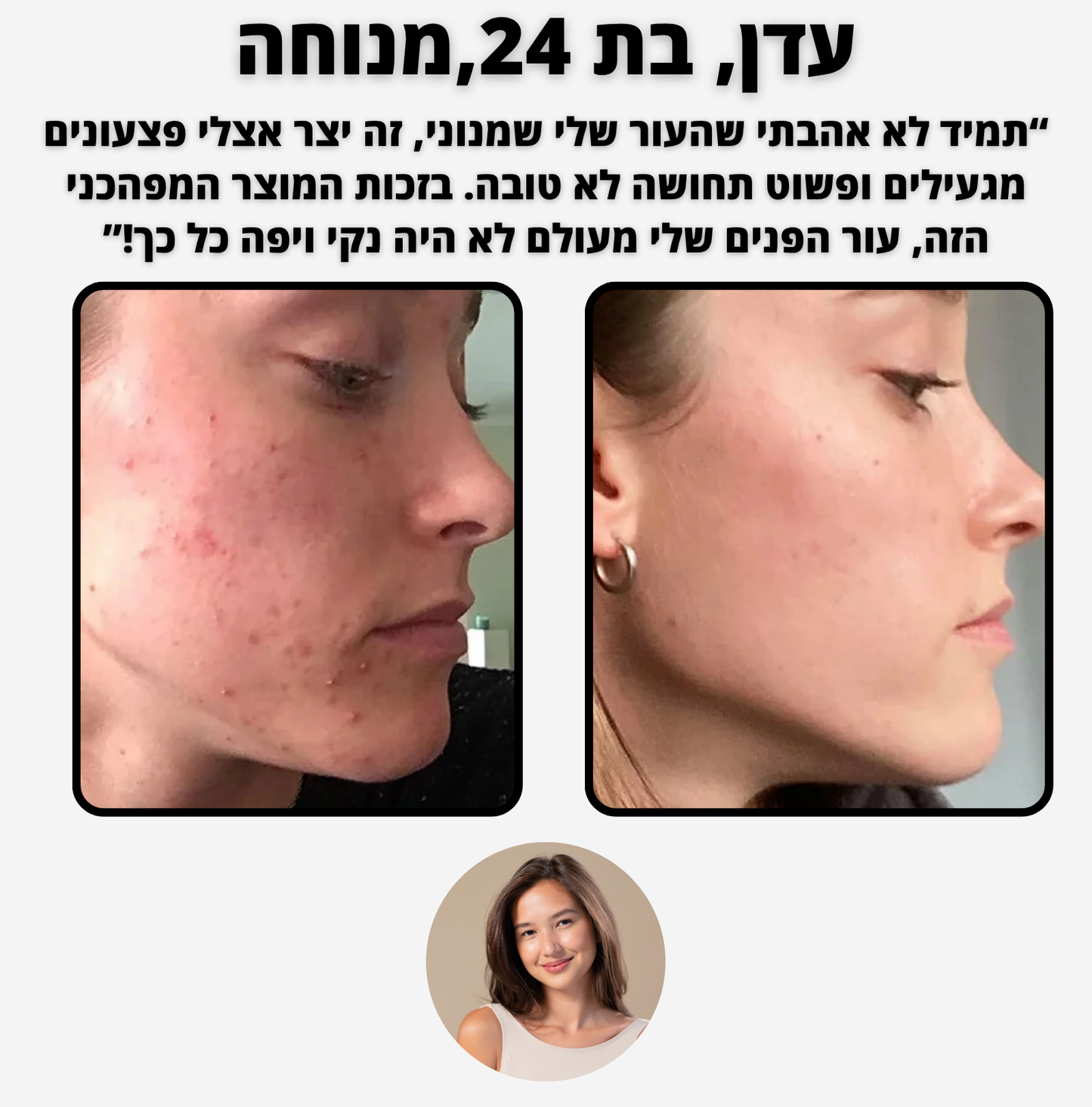 ELI CLEAN - לניקוי עמוק והסרת שחורים, שומנים ואקנה קלים