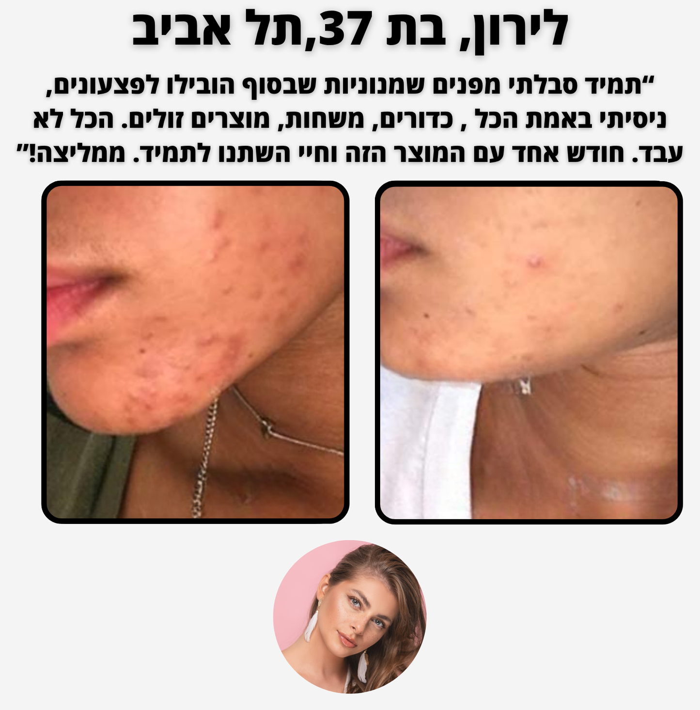 ELI CLEAN - לניקוי עמוק והסרת שחורים, שומנים ואקנה קלים