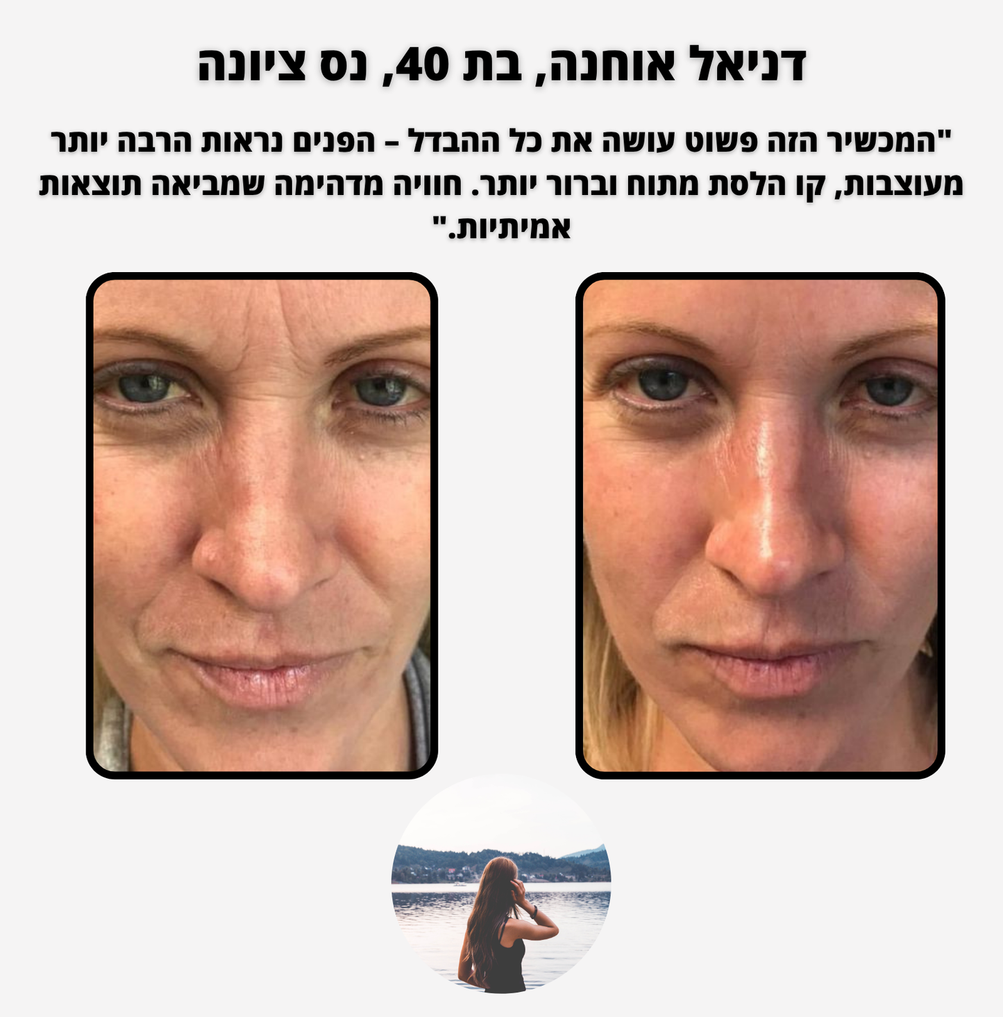 ELI PURE - לעיצוב ופיסול קו הלסת