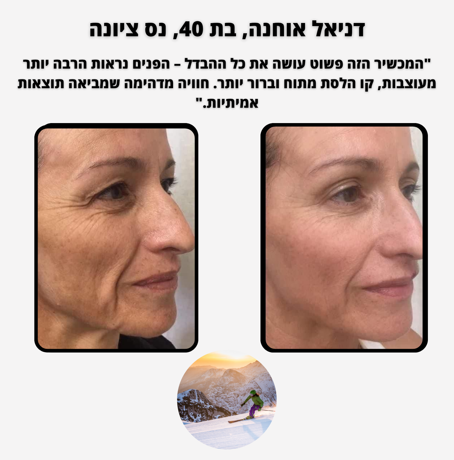 ELI PURE - לעיצוב ופיסול קו הלסת