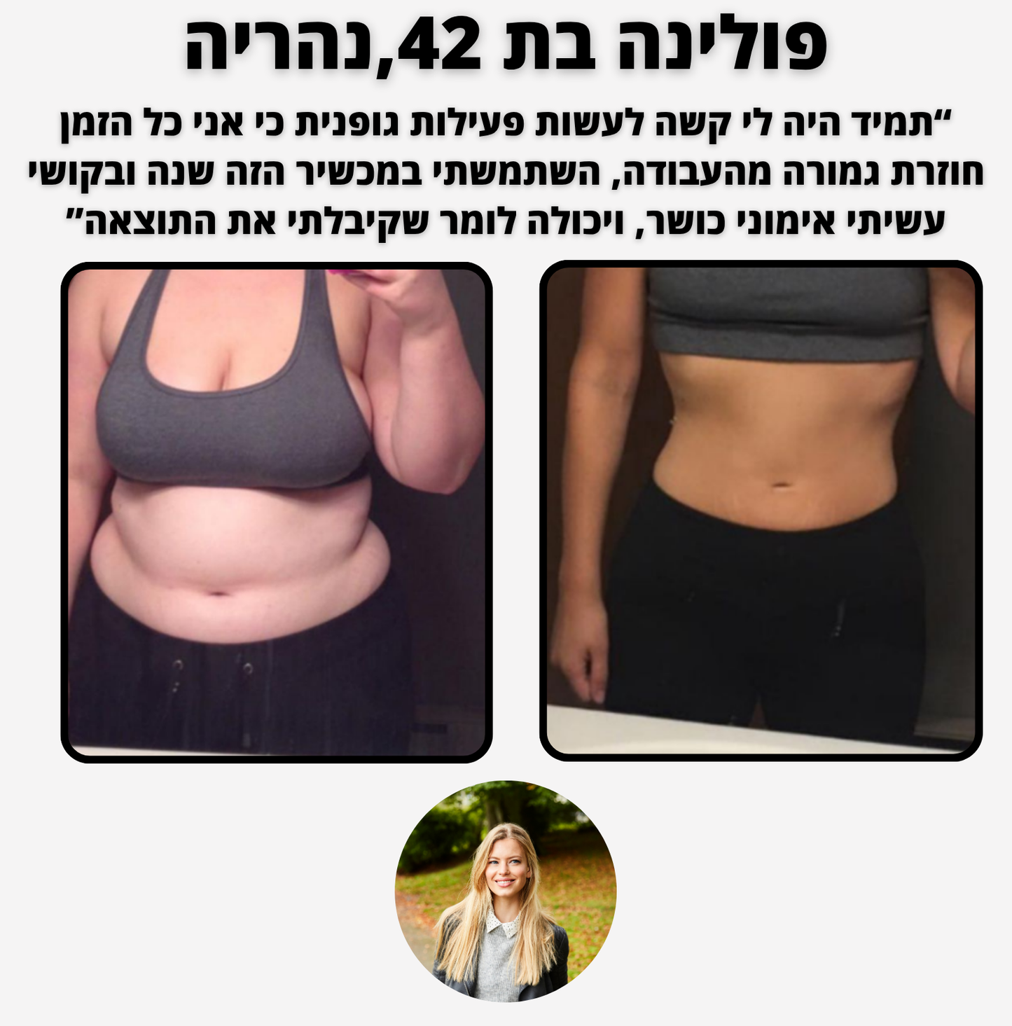 ELI SHAPE - מכשיר מפחית צלוליטיס