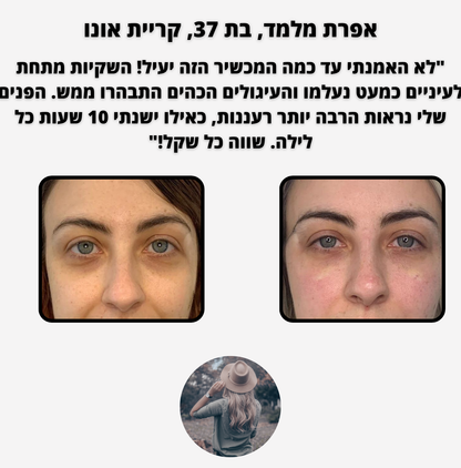 ELI LIFT - לכהויות ושקעי עיניים