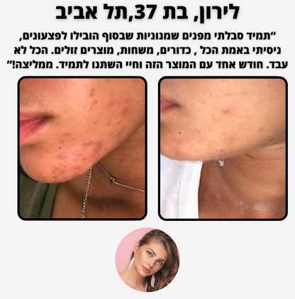 ELI CLEAN - לניקוי עמוק והסרת שחורים, שומנים ואקנה קלים