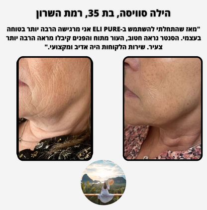 ELI PURE - לעיצוב ופיסול קו הלסת