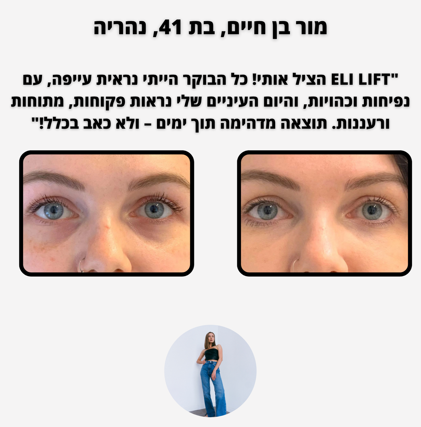ELI LIFT - לכהויות ושקעי עיניים