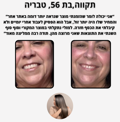 ELI FIX - פיתרון מהיר לעור עייף