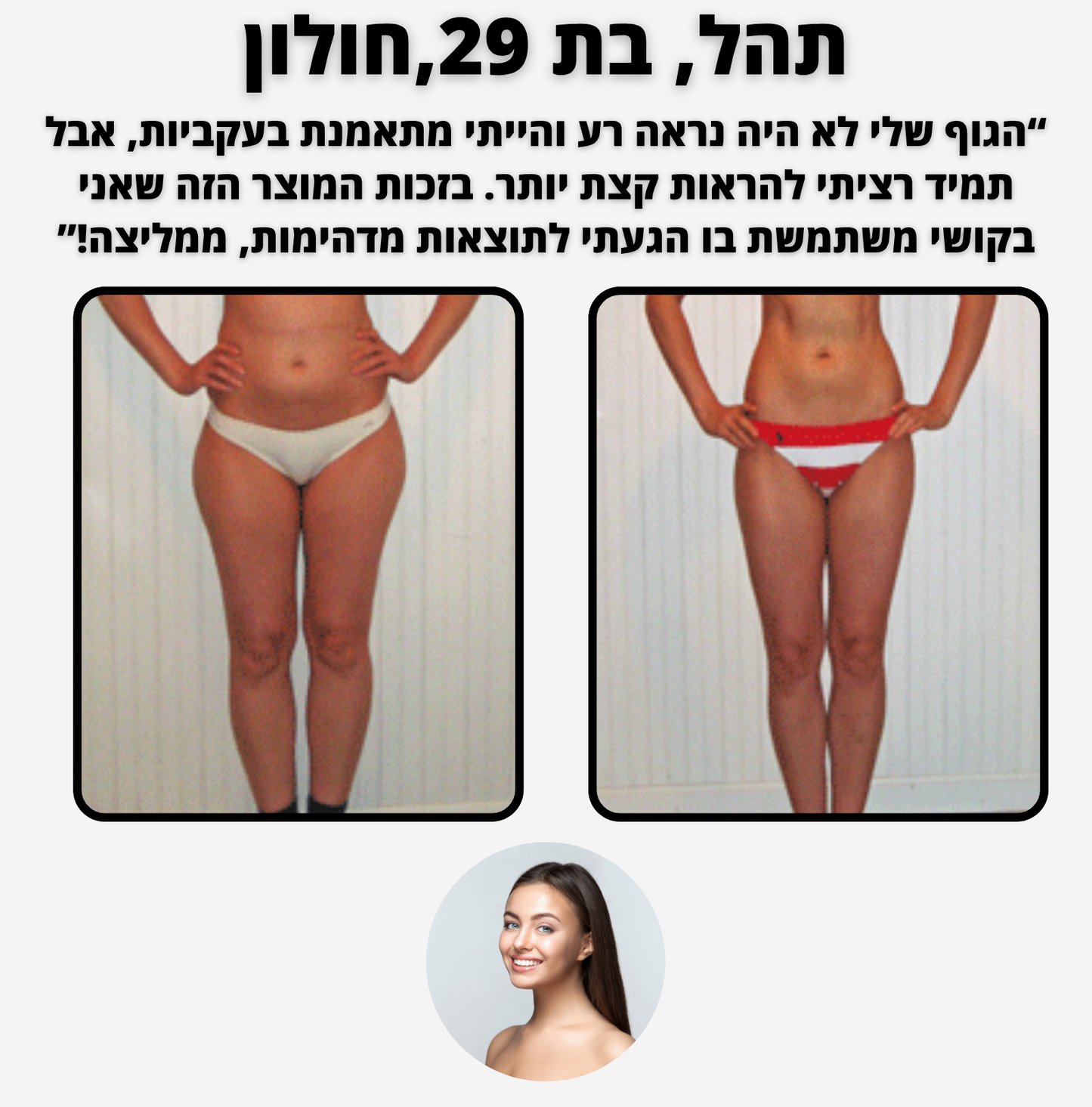 ELI SHAPE - מכשיר מפחית צלוליטיס