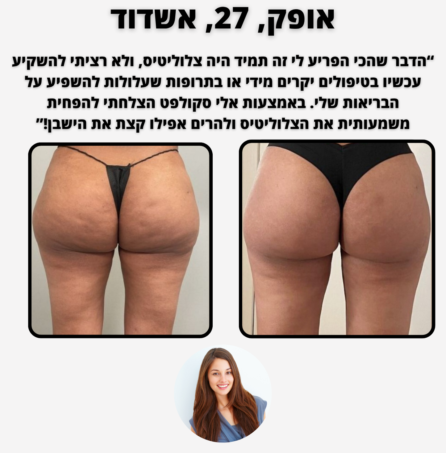 ELI SCULPT - צלוליטיס ומיצוק העור