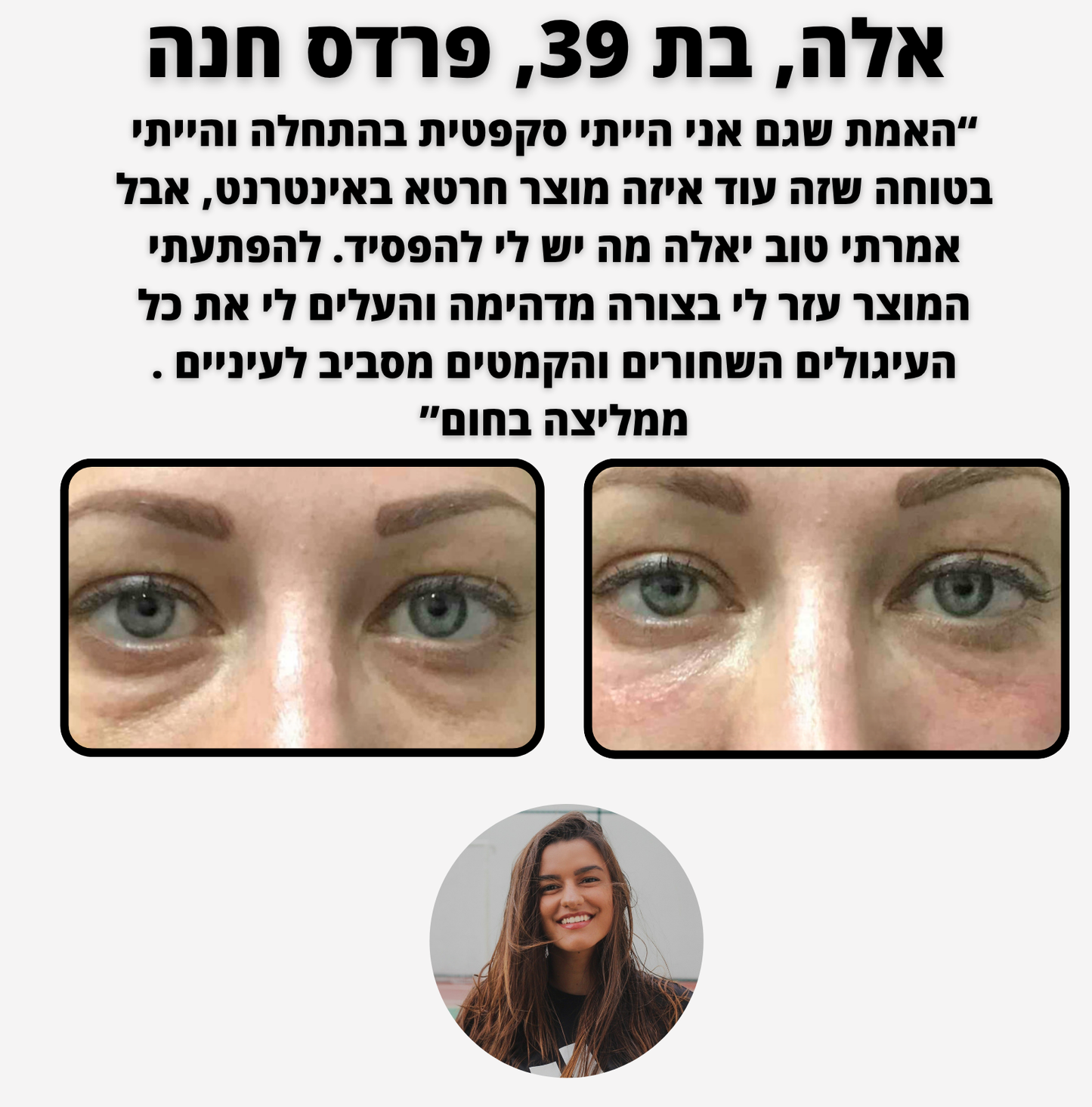 ELI LIFT - לכהויות ושקעי עיניים
