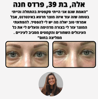 ELI LIFT - לכהויות ושקעי עיניים